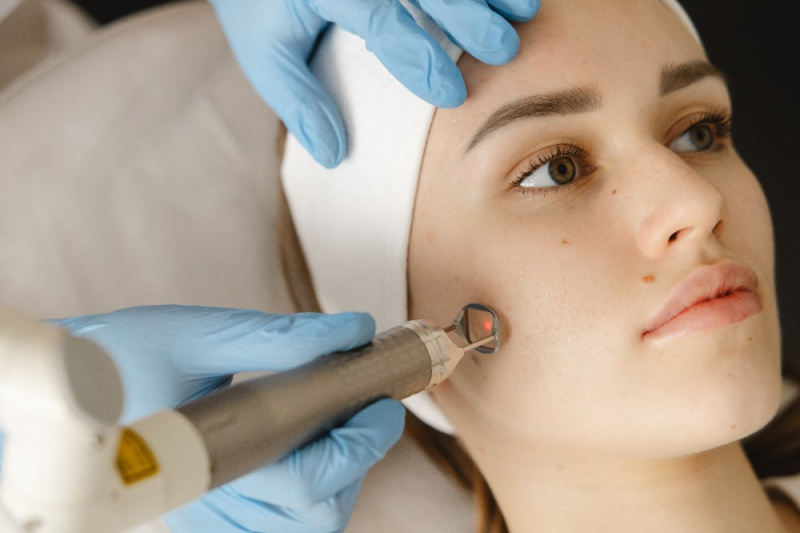 Лазерная шлифовка