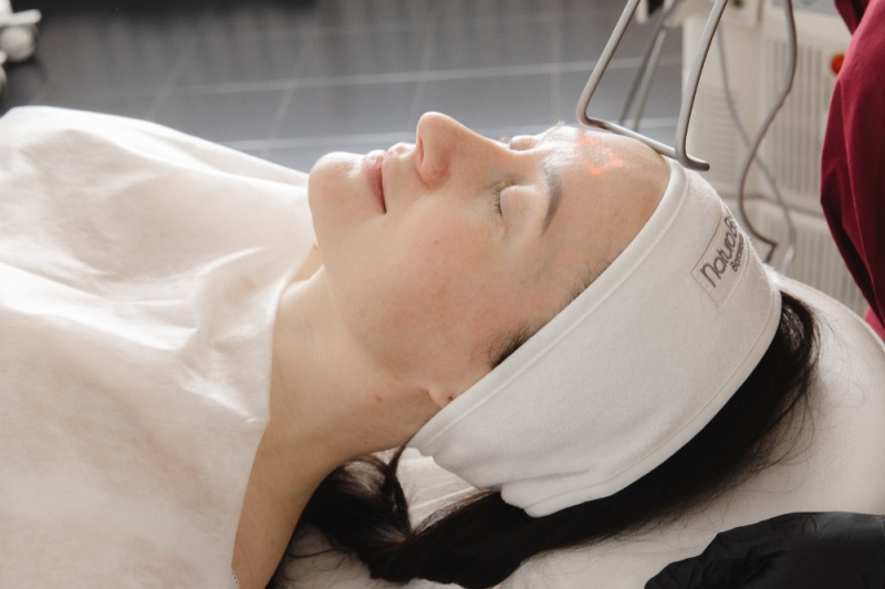 Лазерное омоложение Face Super Lift