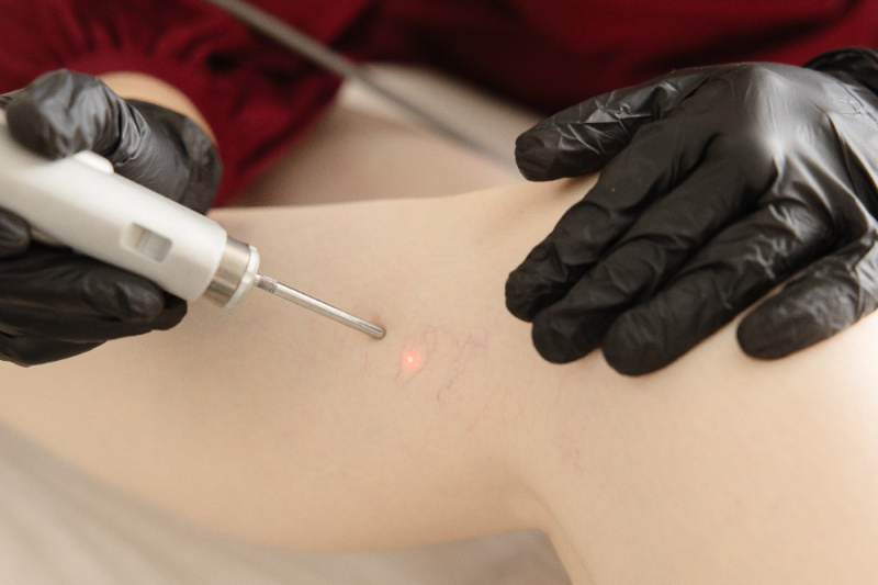 Лечение сосудистых дефектов